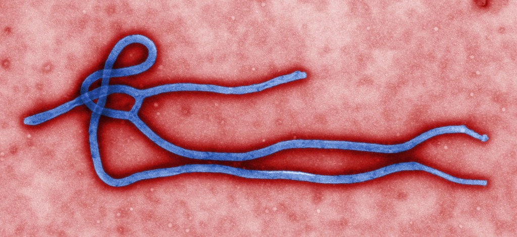 Electron micrograph of the Ebola virus showing its long, threadlike shape against a red background.